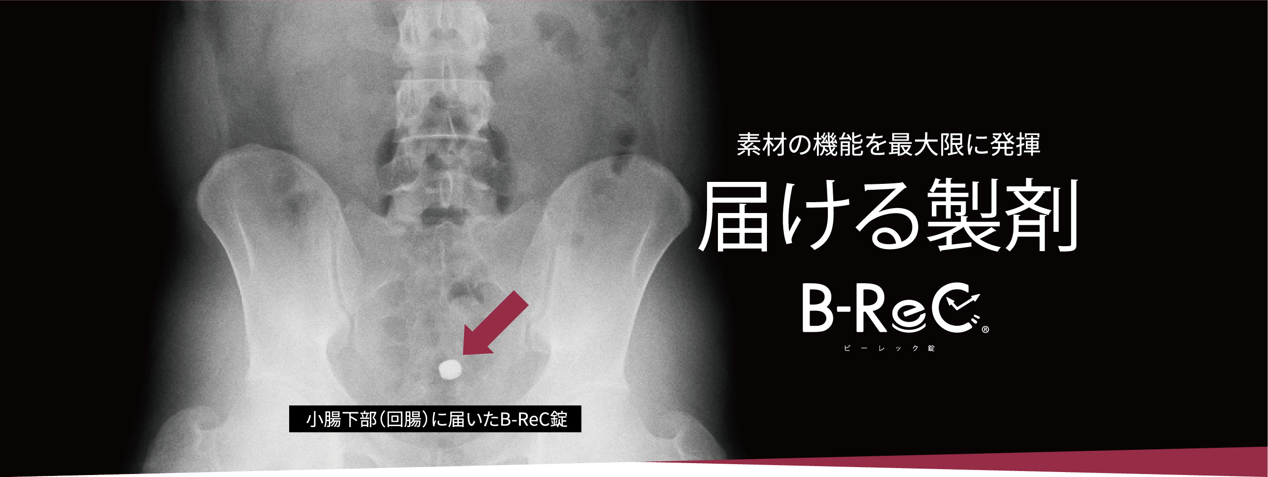 小腸下部（回腸）に届いたB-ReC錠/ 素材の機能を最大限に発揮 届ける製剤 B-ReCビーレック