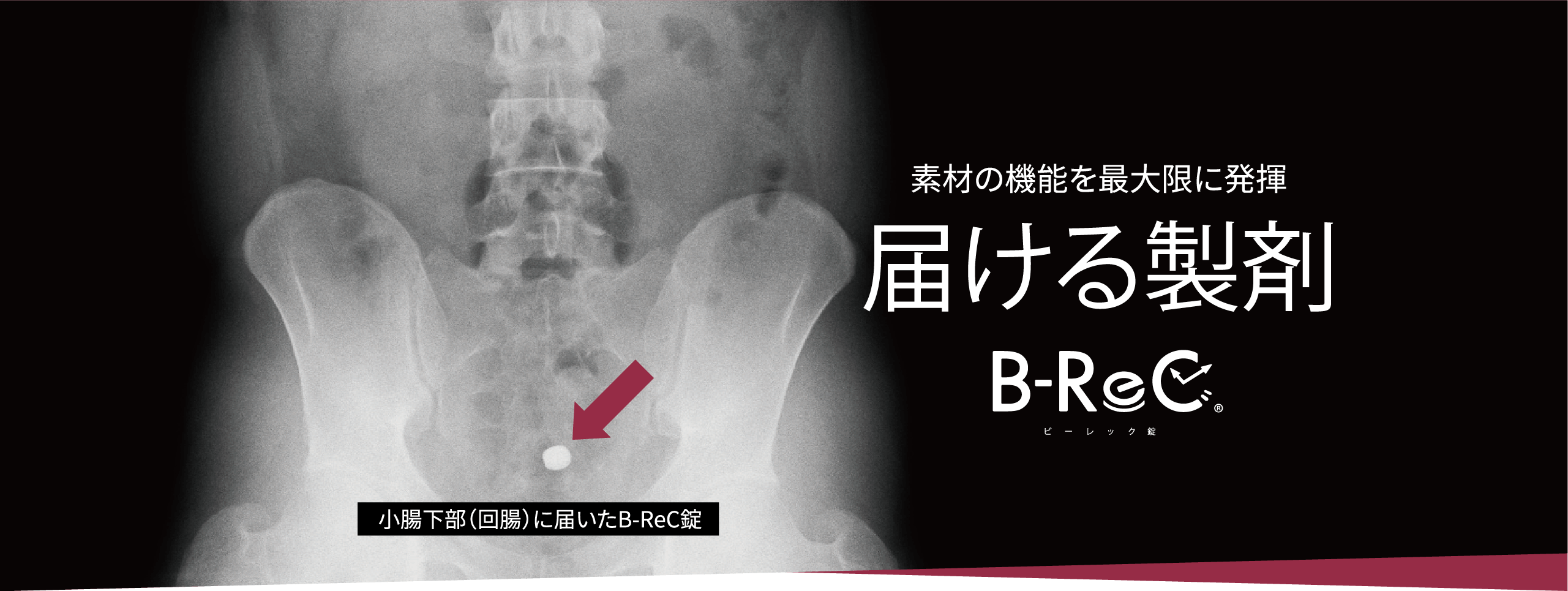 小腸下部(回腸)に届いたB-ReC錠/ 素材の機能を最大限に発揮 届ける製剤 B-ReCビーレック