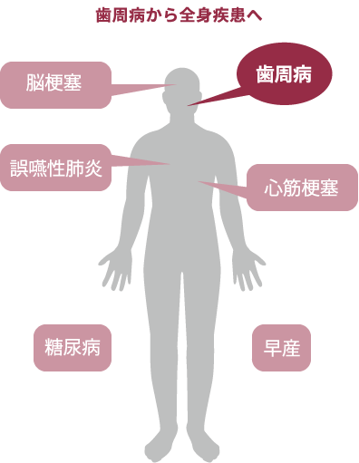 図：歯周病菌から全身疾患へ