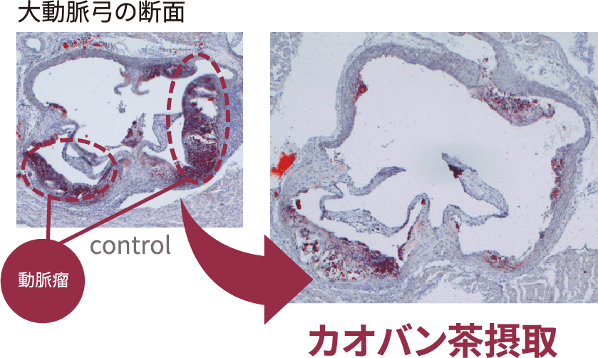 画像：カオバン茶の接種前後の大動脈弓の比較